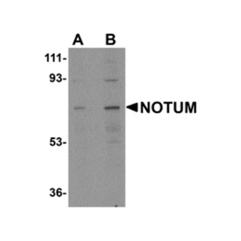 ProSci 5291 NOTUM Antibody, ProSci, 0.1 mg/Unit Primary Image