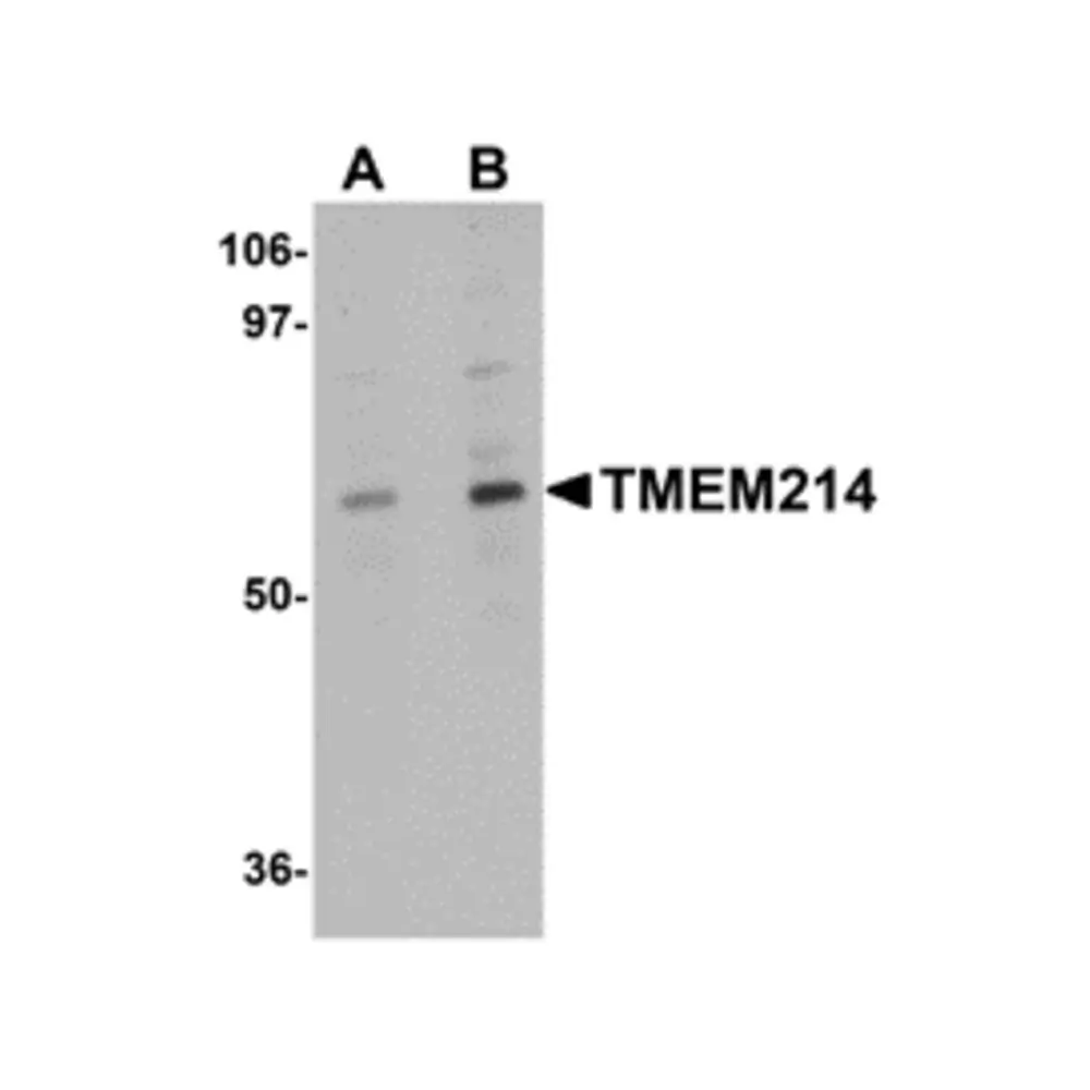 ProSci 5297_S TMEM214 Antibody, ProSci, 0.02 mg/Unit Primary Image