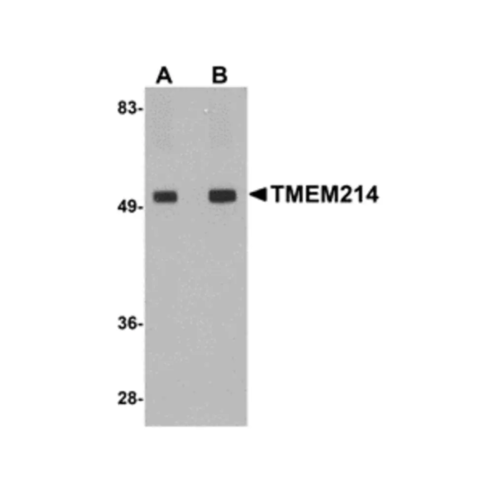 ProSci 5299_S TMEM214 Antibody, ProSci, 0.02 mg/Unit Primary Image