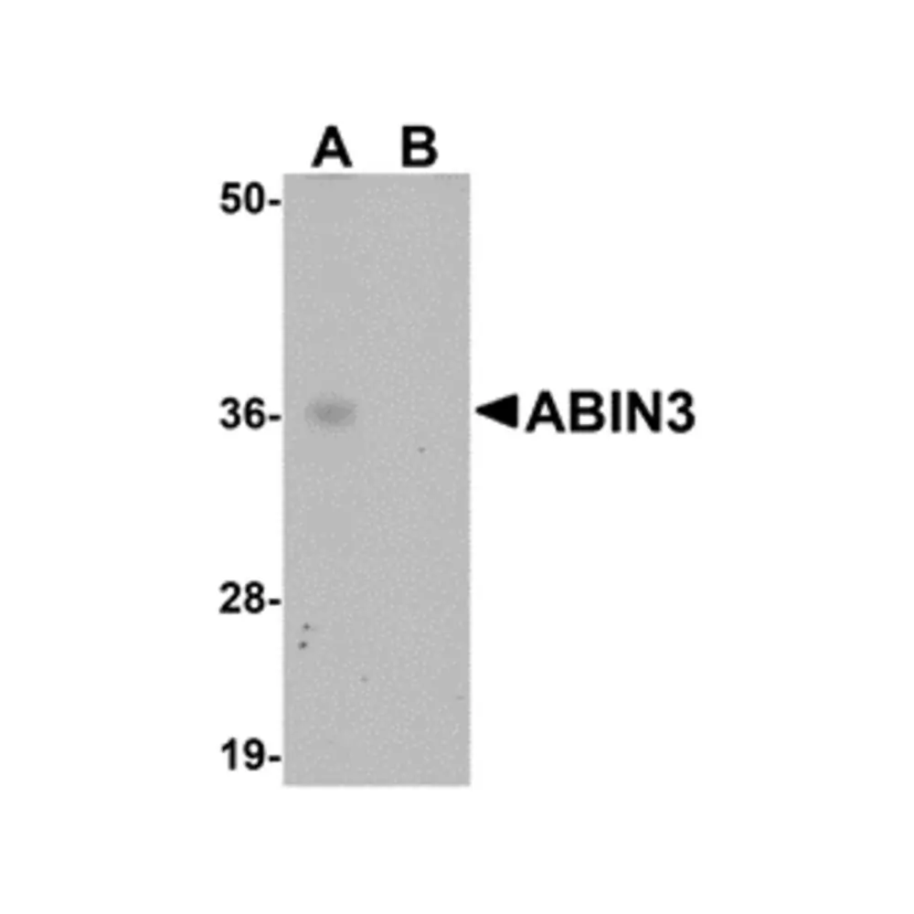 ProSci 5303_S ABIN3 Antibody, ProSci, 0.02 mg/Unit Primary Image