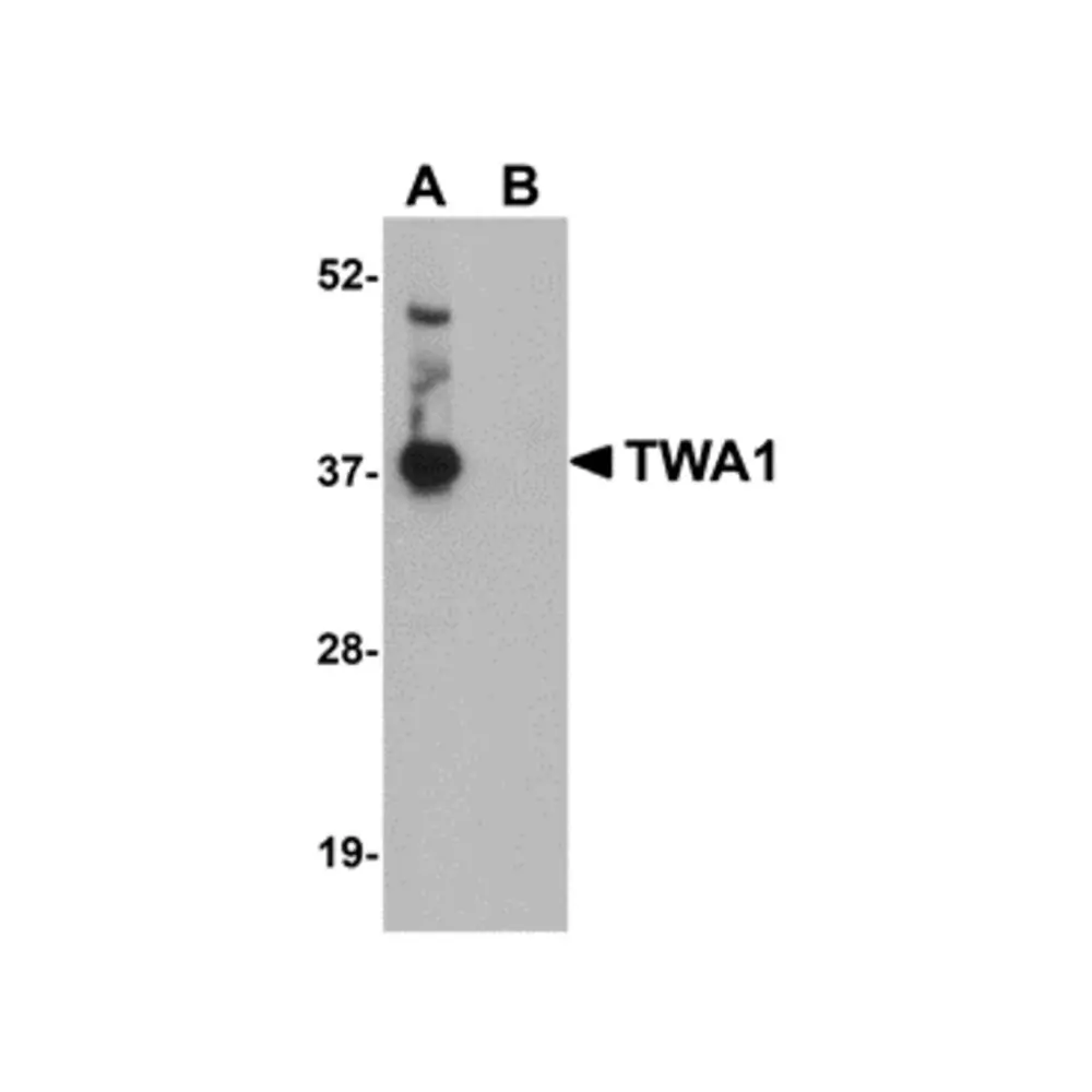 ProSci 5305 TWA1 Antibody, ProSci, 0.1 mg/Unit Primary Image