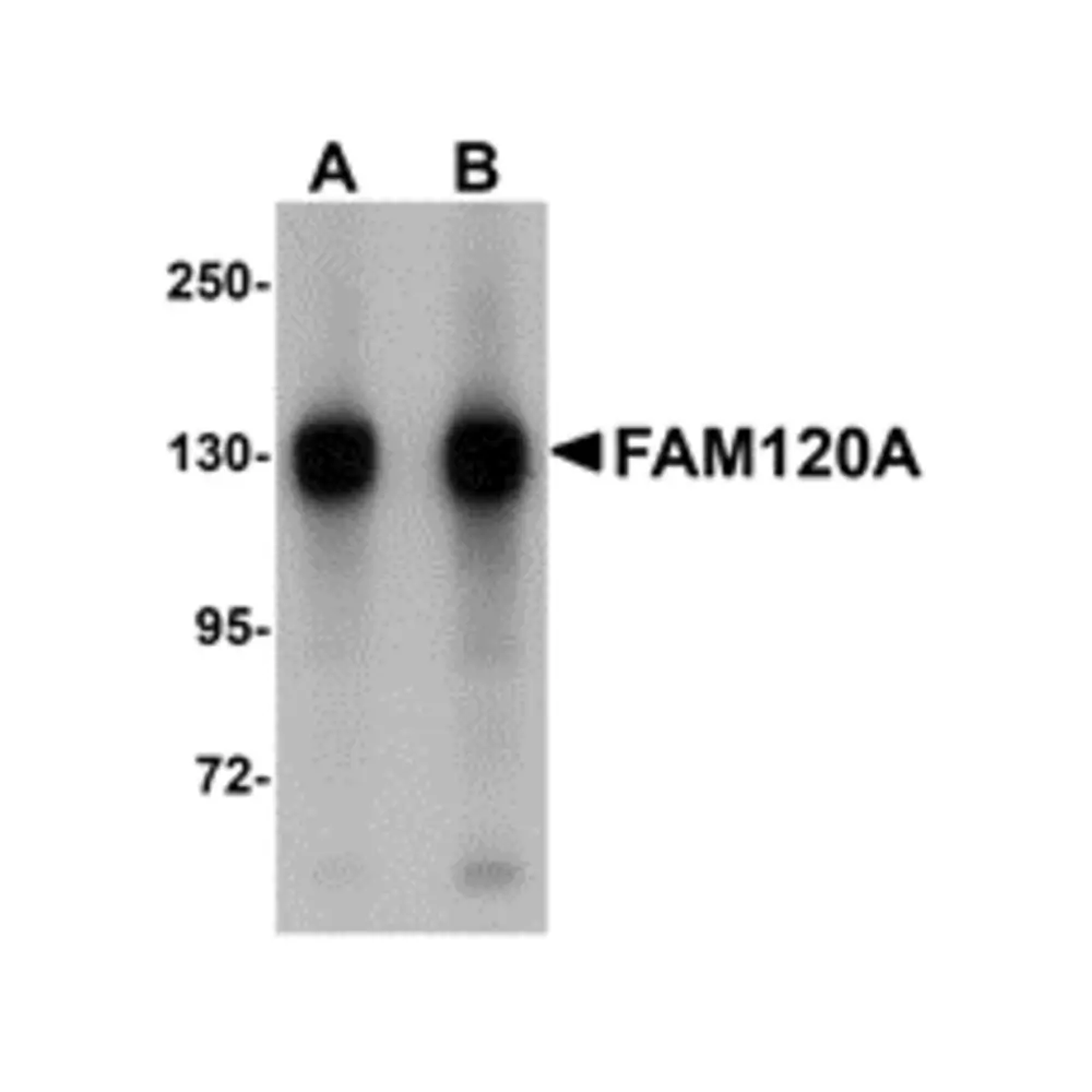 ProSci 5307 FAM120A Antibody, ProSci, 0.1 mg/Unit Primary Image