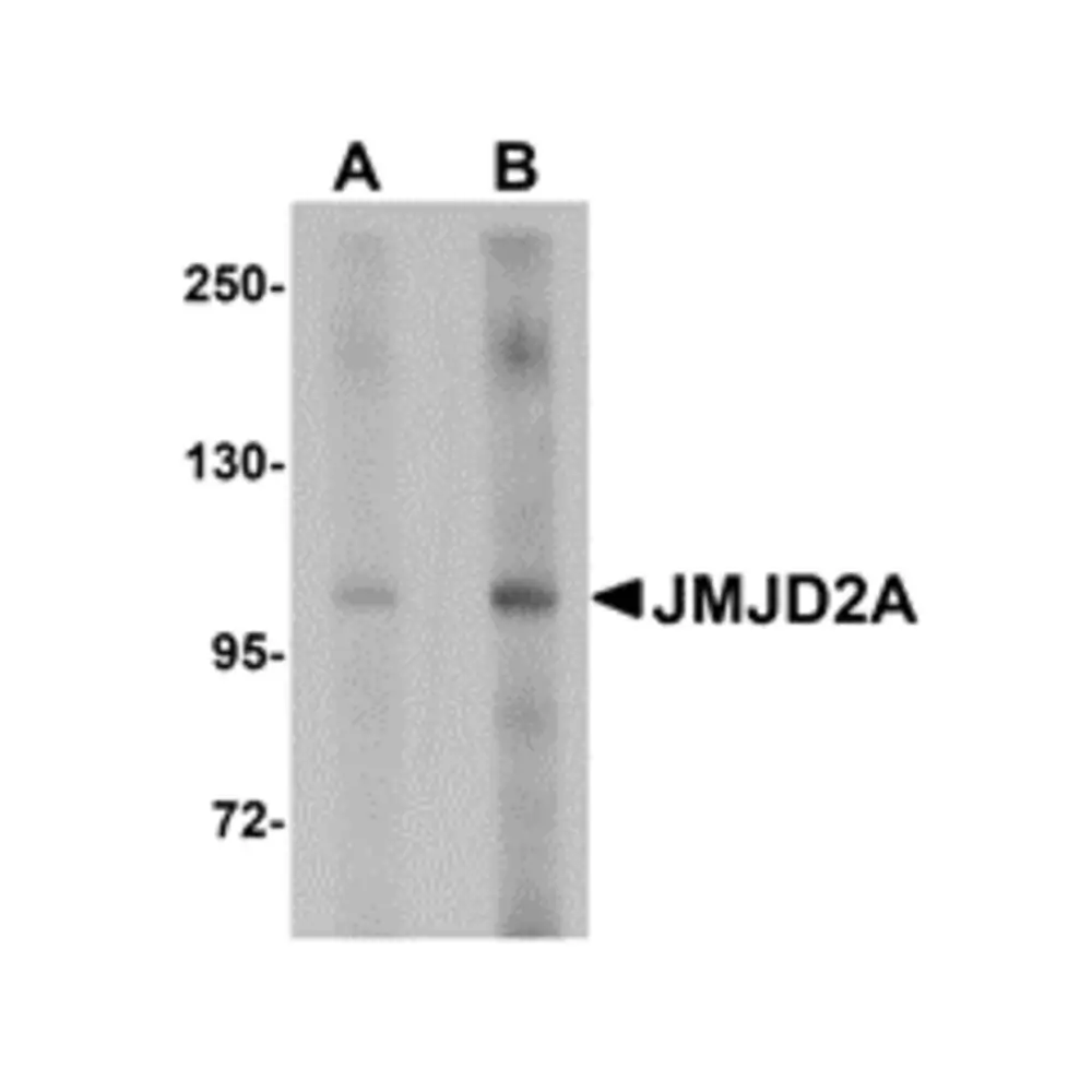 ProSci 5373_S JMJD2A Antibody, ProSci, 0.02 mg/Unit Primary Image