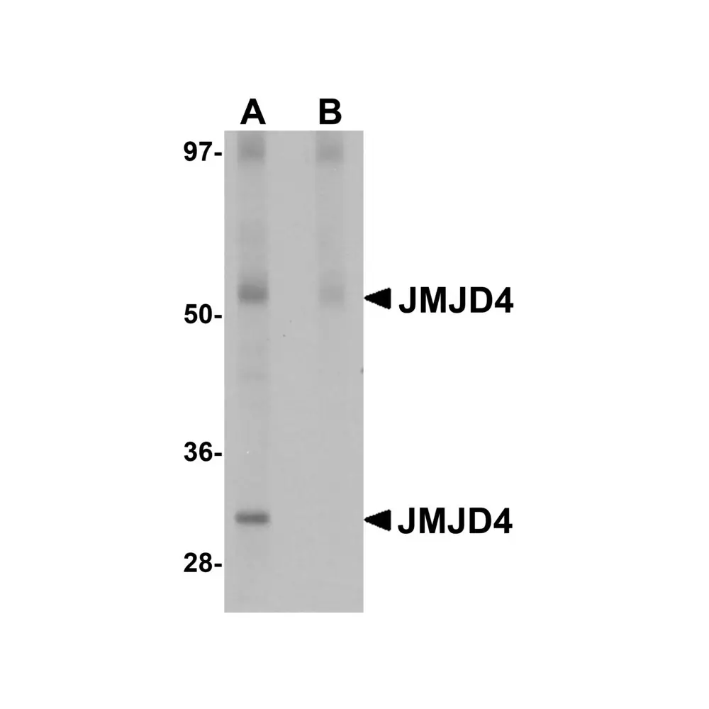 ProSci 5379 JMJD4 Antibody, ProSci, 0.1 mg/Unit Primary Image