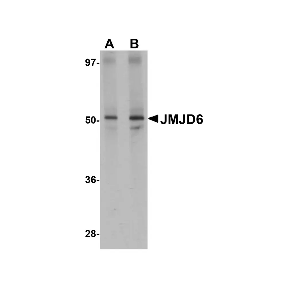 ProSci 5383_S JMJD6 Antibody, ProSci, 0.02 mg/Unit Primary Image