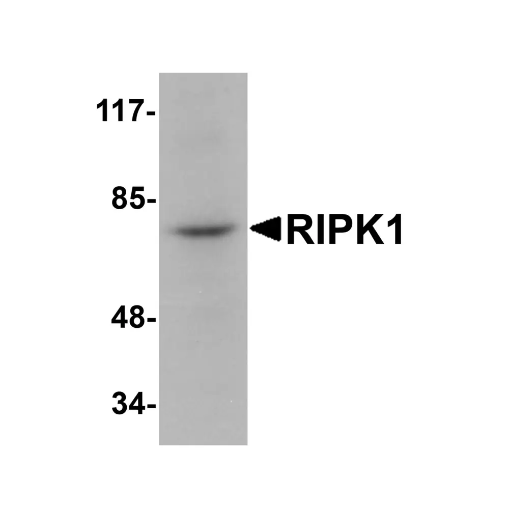 ProSci 5389 RIPK1 Antibody, ProSci, 0.1 mg/Unit Primary Image