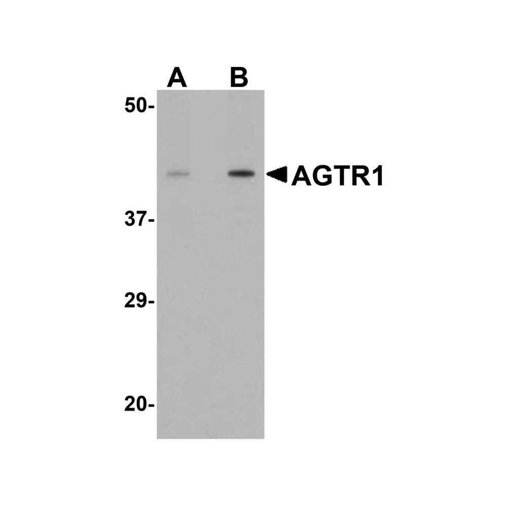 ProSci 5391 AGTR1 Antibody, ProSci, 0.1 mg/Unit Primary Image