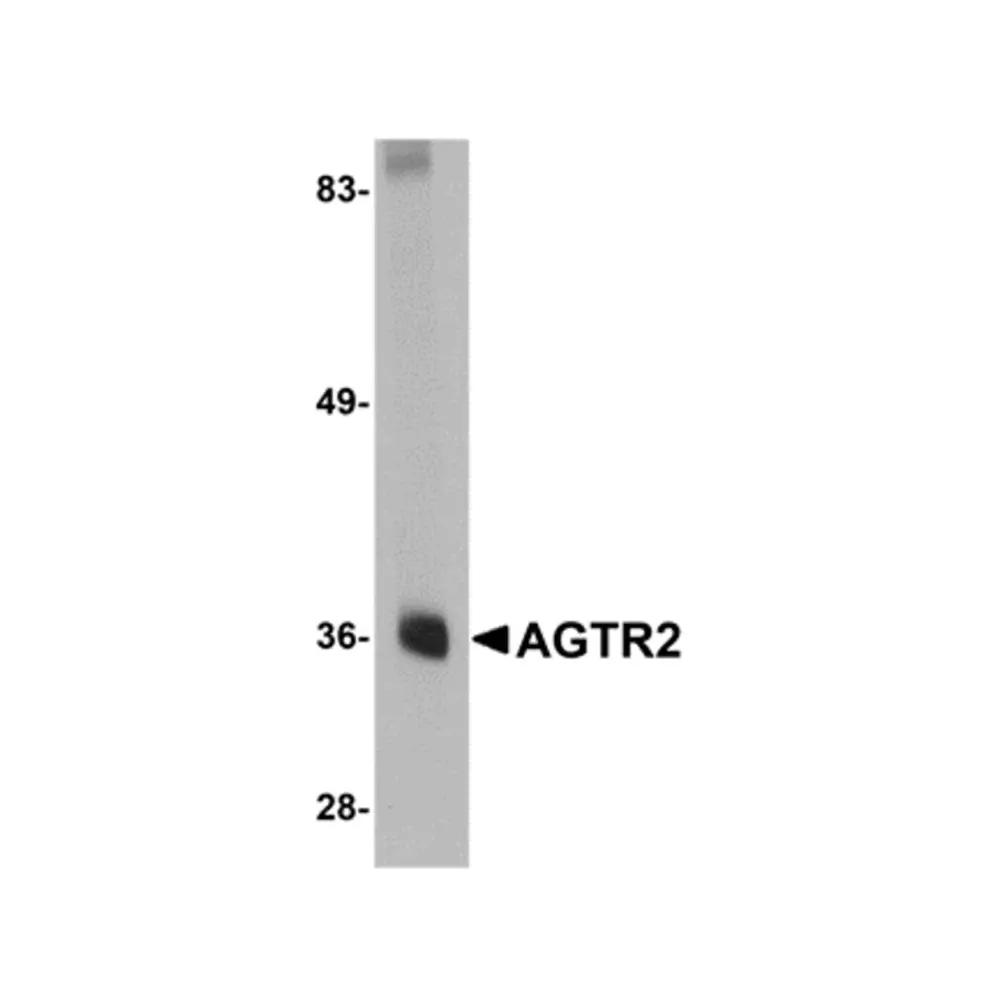 ProSci 5393 AGTR2 Antibody, ProSci, 0.1 mg/Unit Primary Image
