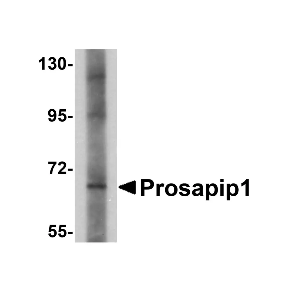 ProSci 5395_S Prosapip1 Antibody, ProSci, 0.02 mg/Unit Primary Image