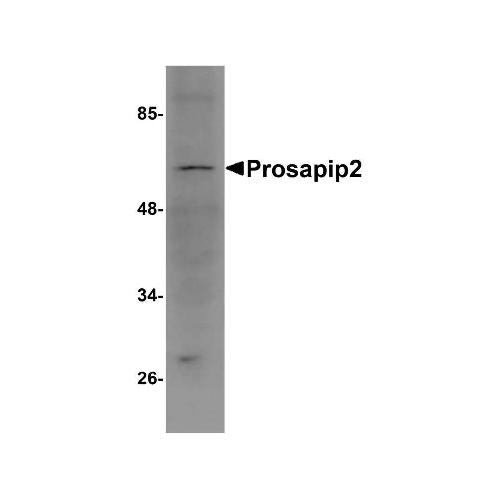 ProSci 5397_S Prosapip2 Antibody, ProSci, 0.02 mg/Unit Primary Image