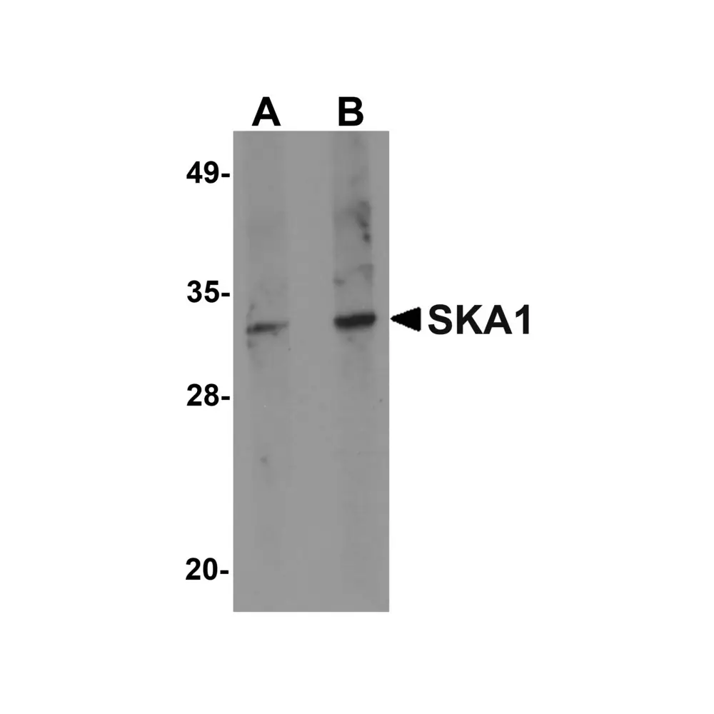 ProSci 5401 SKA1 Antibody, ProSci, 0.1 mg/Unit Primary Image