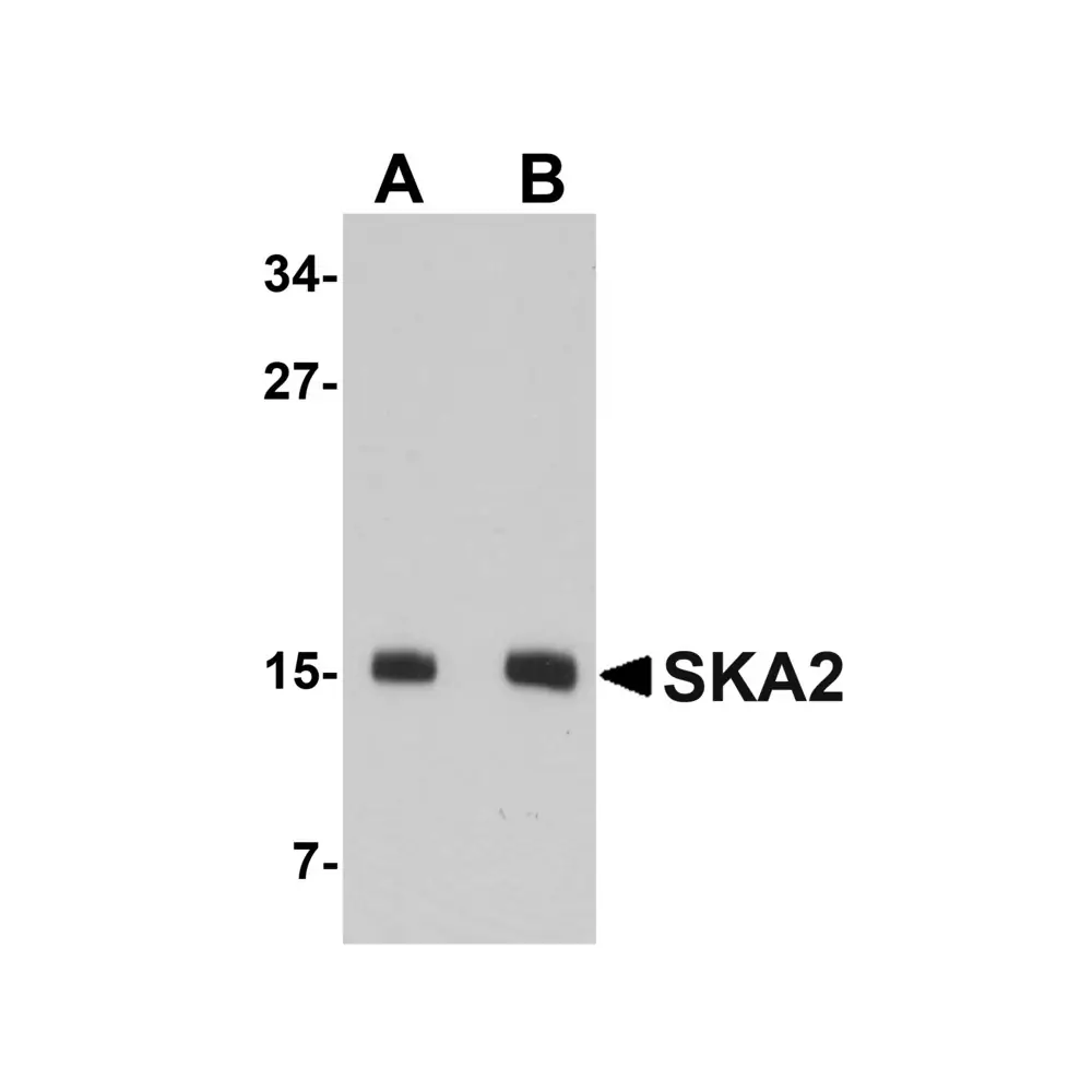 ProSci 5403 SKA2 Antibody, ProSci, 0.1 mg/Unit Primary Image
