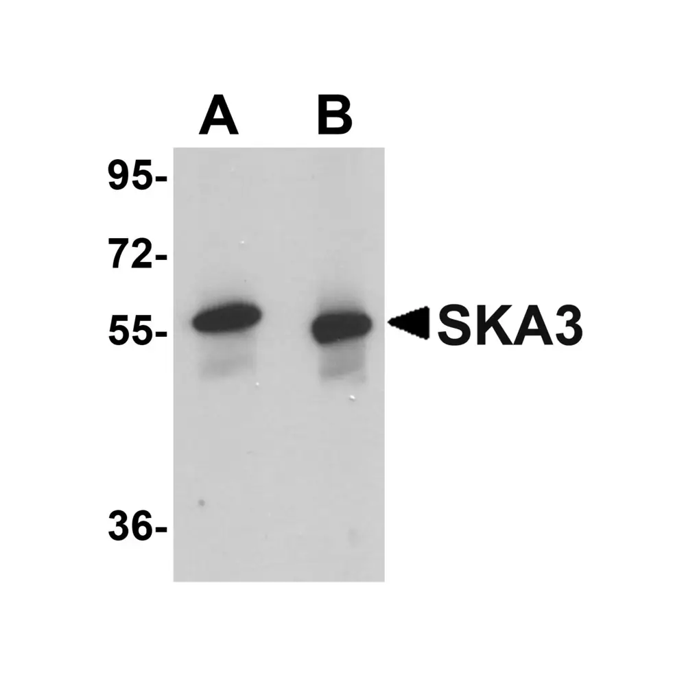 ProSci 5405 SKA3 Antibody, ProSci, 0.1 mg/Unit Primary Image