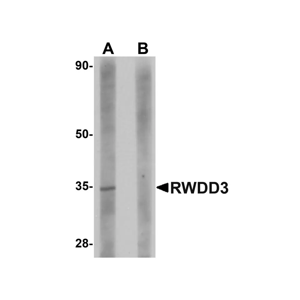 ProSci 5407 RWDD3 Antibody, ProSci, 0.1 mg/Unit Primary Image