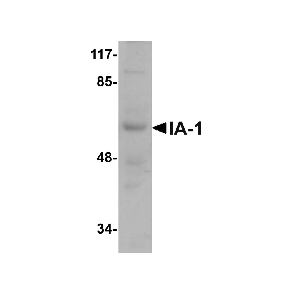 ProSci 5415 IA-1 Antibody, ProSci, 0.1 mg/Unit Primary Image