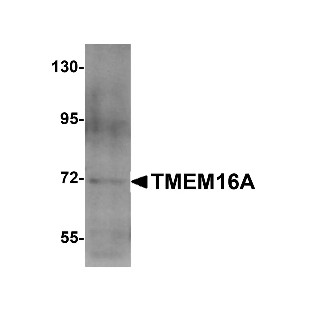 ProSci 5419_S TMEM16A Antibody, ProSci, 0.02 mg/Unit Primary Image