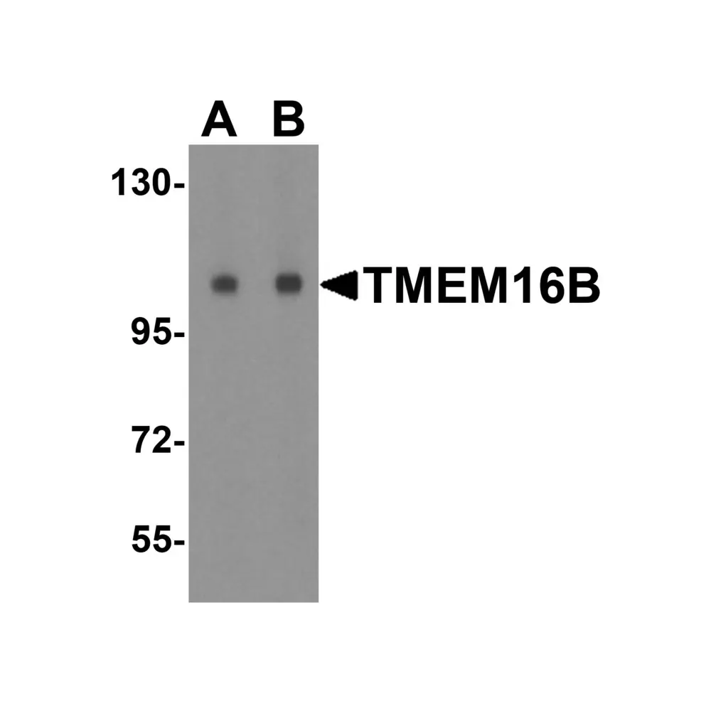 ProSci 5421 TMEM16B Antibody, ProSci, 0.1 mg/Unit Primary Image