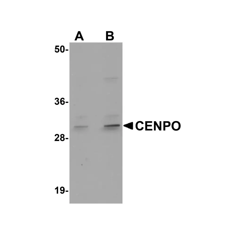 ProSci 5433_S CENPO Antibody, ProSci, 0.02 mg/Unit Primary Image