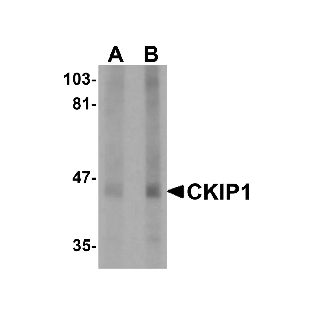 ProSci 5435 CKIP1 Antibody, ProSci, 0.1 mg/Unit Primary Image