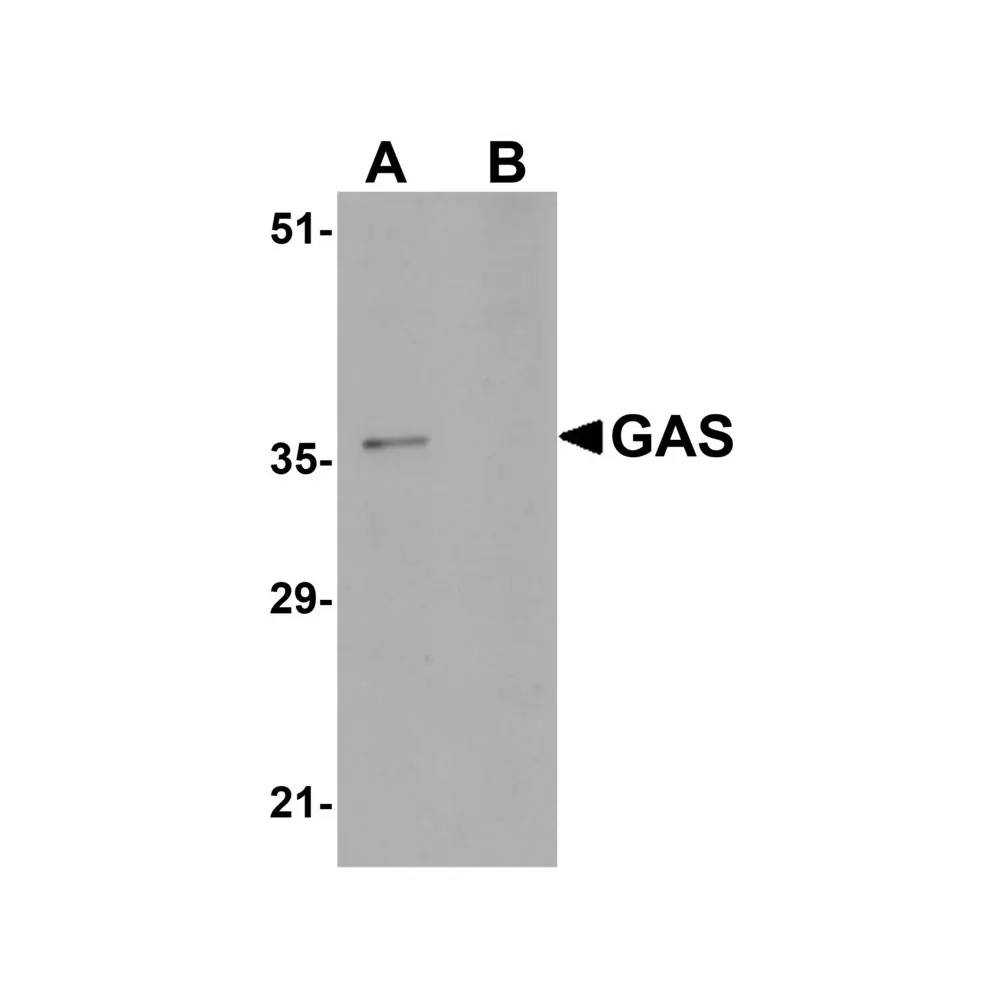 ProSci 5437_S GAS Antibody, ProSci, 0.02 mg/Unit Primary Image