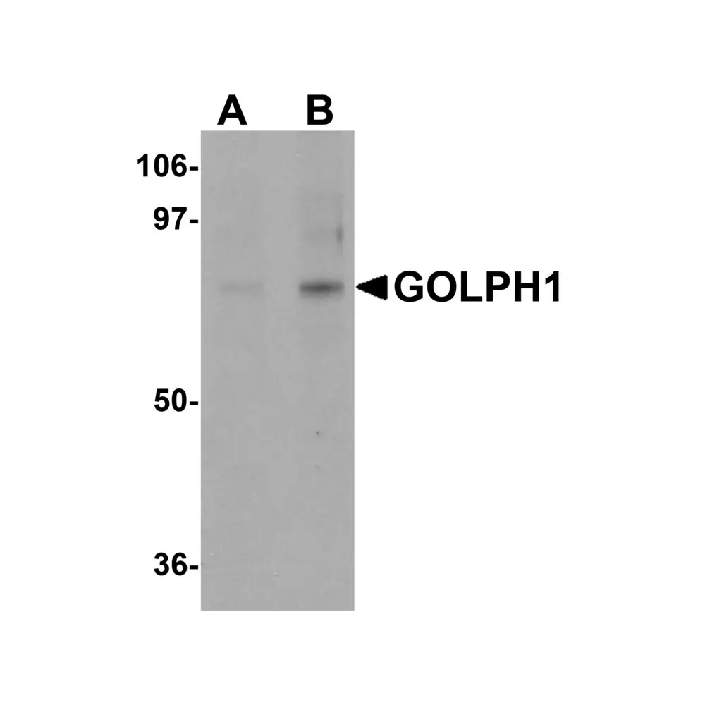ProSci 5439_S GOLPH1 Antibody, ProSci, 0.02 mg/Unit Primary Image