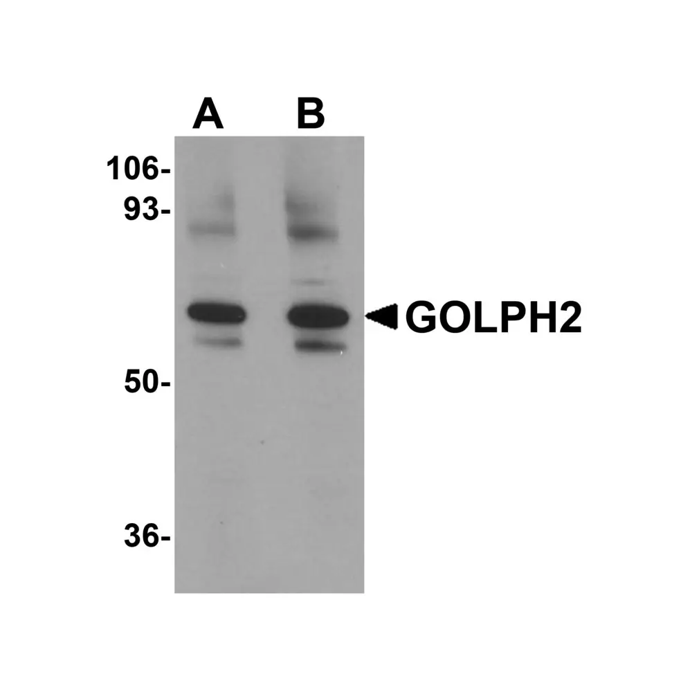 ProSci 5441 GOLPH2 Antibody, ProSci, 0.1 mg/Unit Primary Image