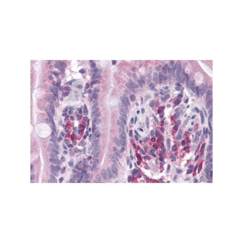 ProSci 5451 VARP Antibody, ProSci, 0.1 mg/Unit Primary Image