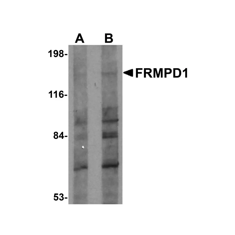 ProSci 5453_S FRMPD1 Antibody, ProSci, 0.02 mg/Unit Primary Image