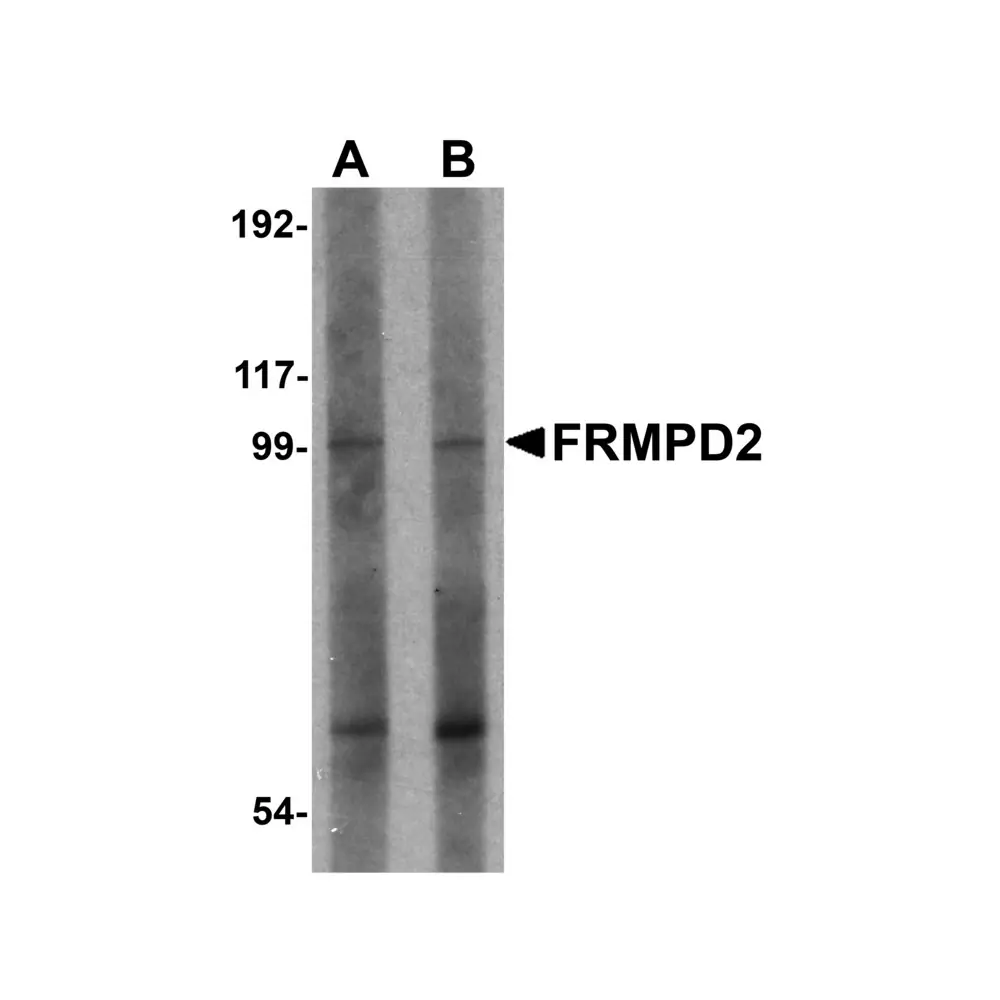 ProSci 5455_S FRMPD2 Antibody, ProSci, 0.02 mg/Unit Primary Image