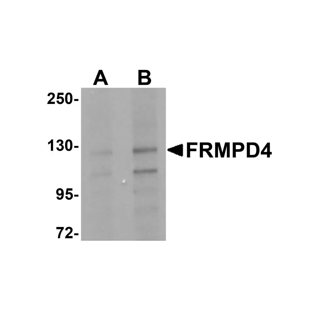 ProSci 5459 FRMPD4 Antibody, ProSci, 0.1 mg/Unit Primary Image