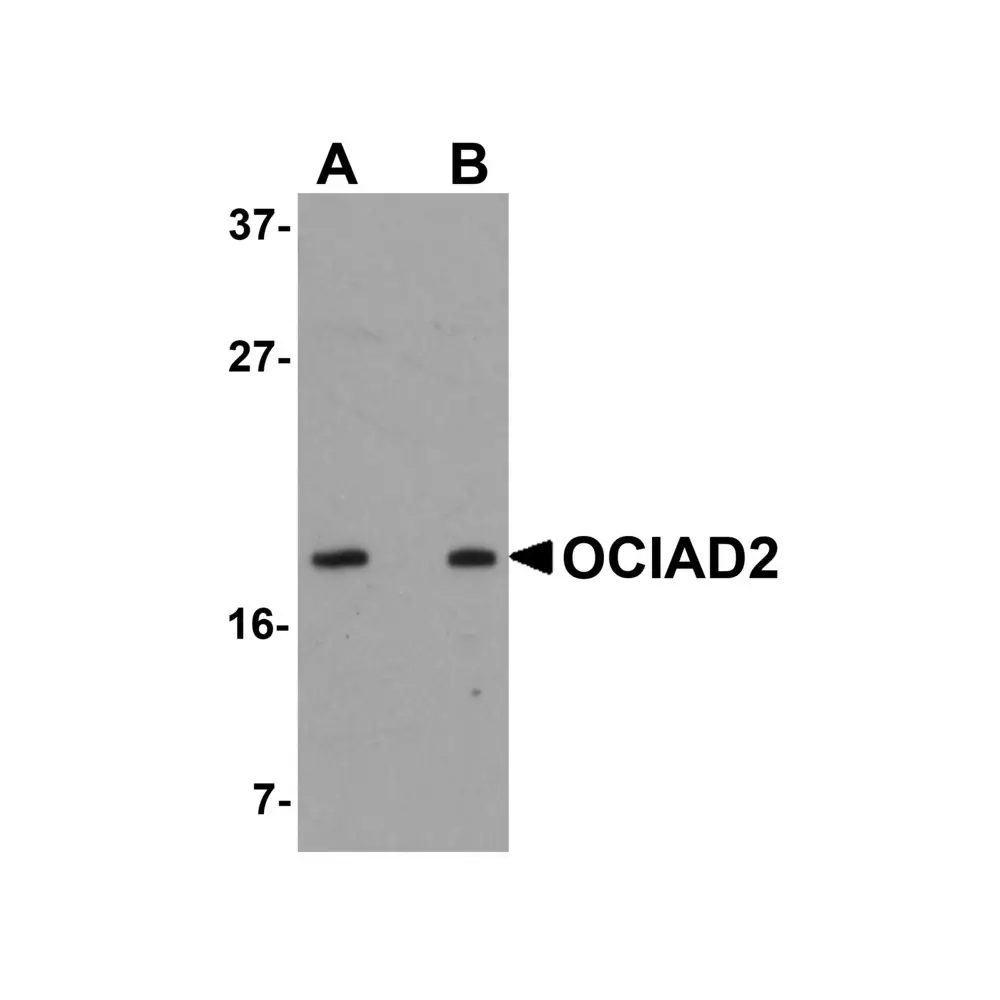 ProSci 5465_S OCIAD2 Antibody, ProSci, 0.02 mg/Unit Primary Image
