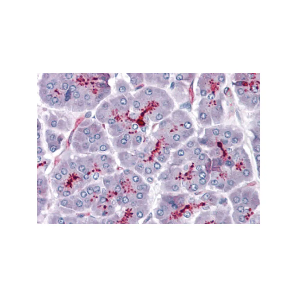 ProSci 5467 SLAIN1 Antibody, ProSci, 0.1 mg/Unit Primary Image
