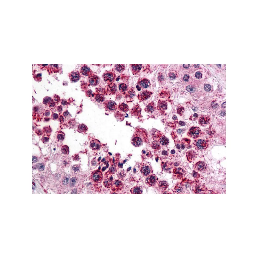 ProSci 5471 SLAIN2 Antibody, ProSci, 0.1 mg/Unit Primary Image