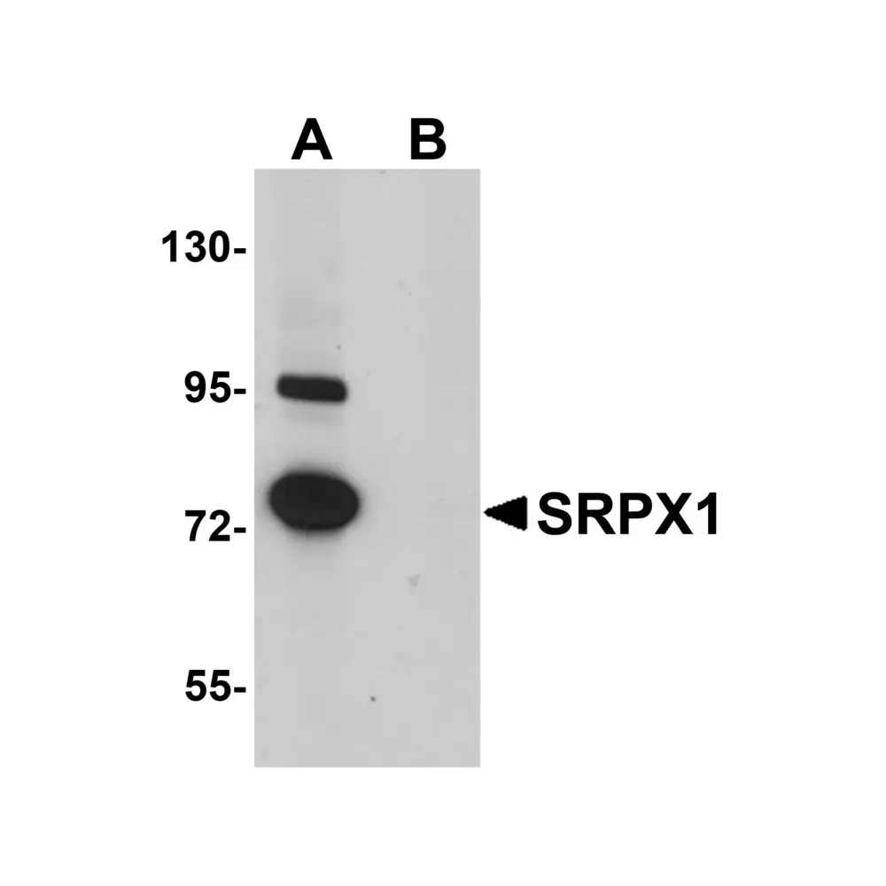 ProSci 5473_S SRPX1 Antibody, ProSci, 0.02 mg/Unit Primary Image