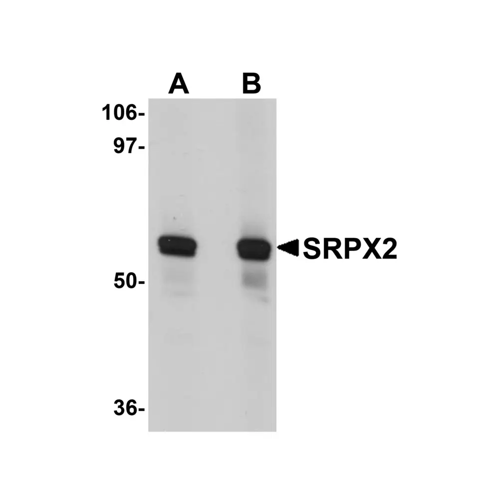 ProSci 5475 SRPX2 Antibody, ProSci, 0.1 mg/Unit Primary Image