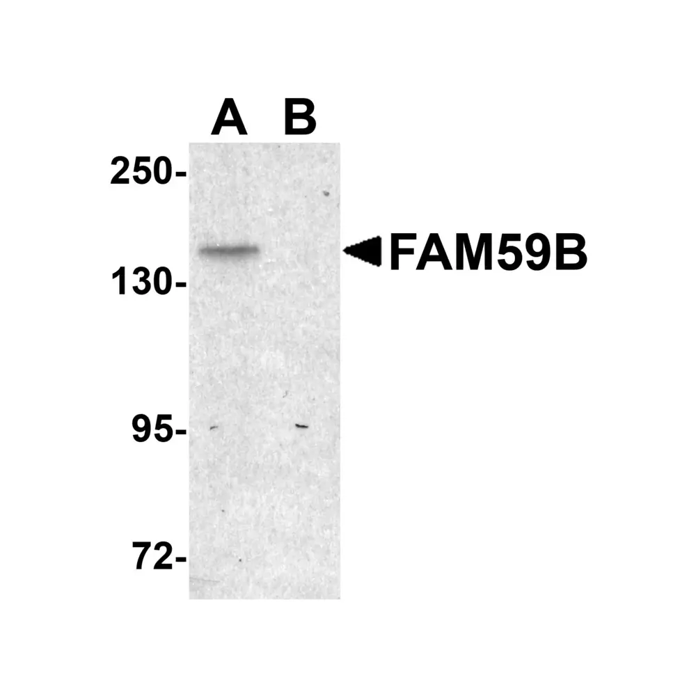 ProSci 5481 FAM59B Antibody, ProSci, 0.1 mg/Unit Primary Image