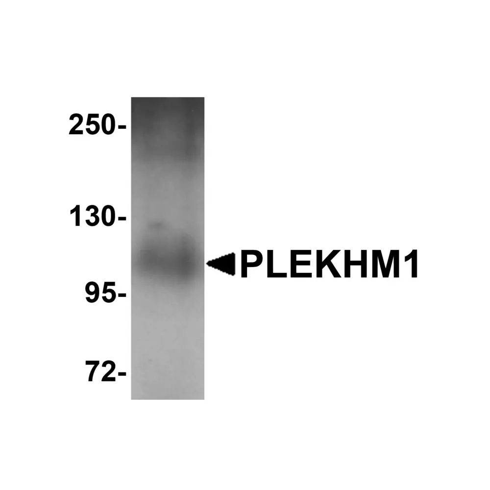 ProSci 5483_S PLEKHM1 Antibody, ProSci, 0.02 mg/Unit Primary Image