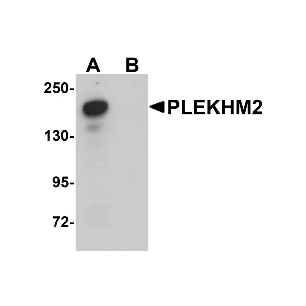 ProSci 5485 PLEKHM2 Antibody, ProSci, 0.1 mg/Unit Primary Image
