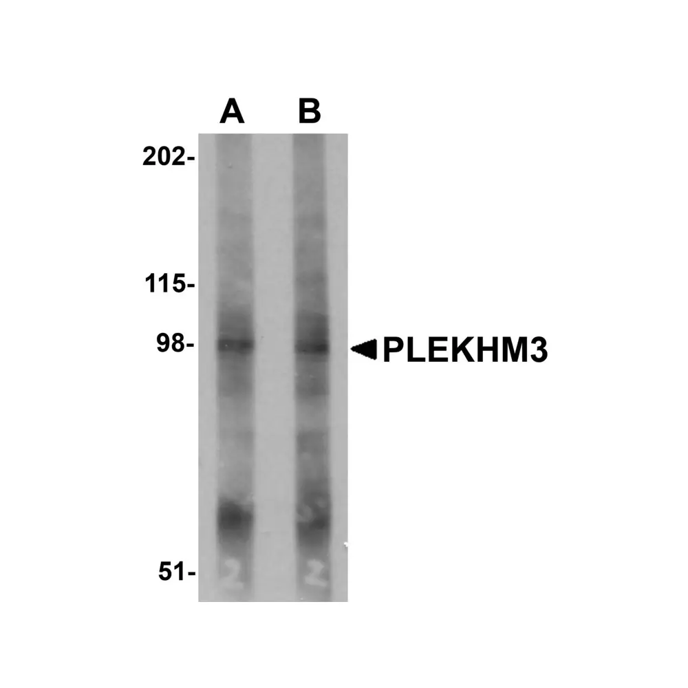 ProSci 5487 PLEKHM3 Antibody, ProSci, 0.1 mg/Unit Primary Image