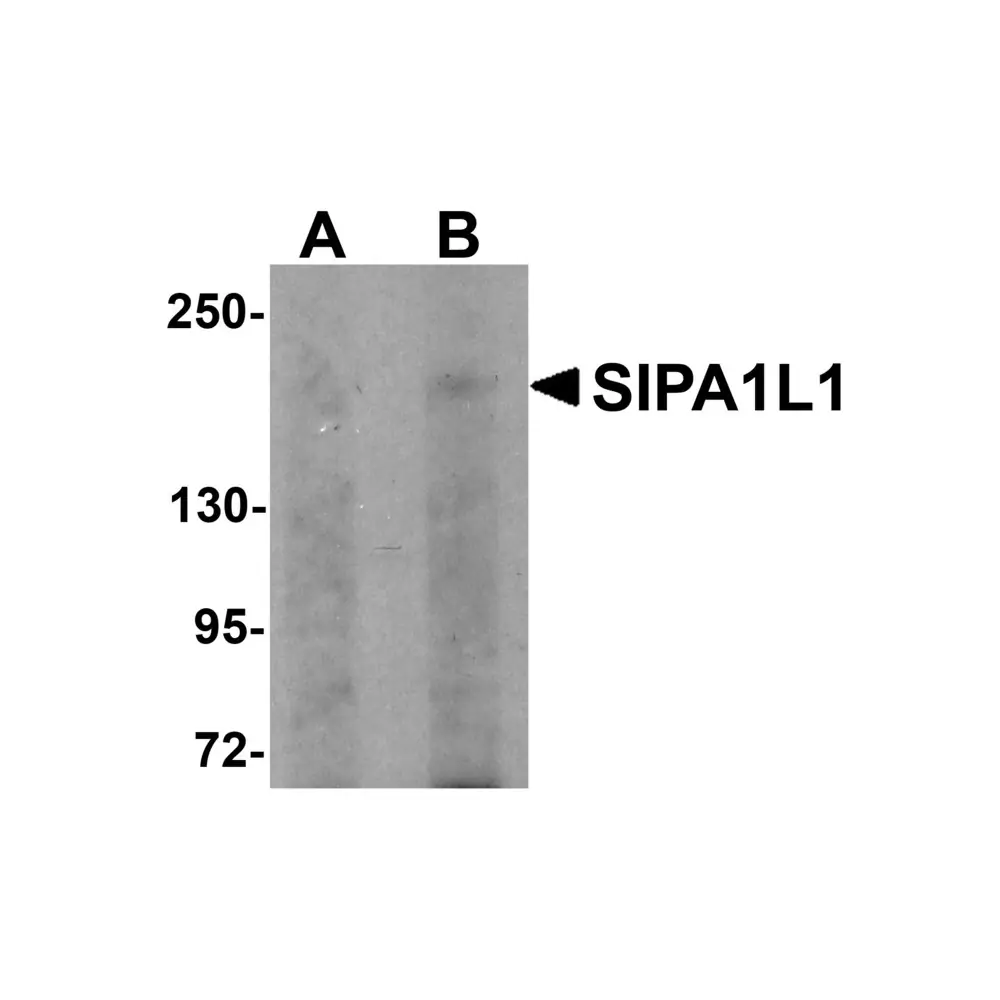 ProSci 5491 SIPA1L1 Antibody, ProSci, 0.1 mg/Unit Primary Image