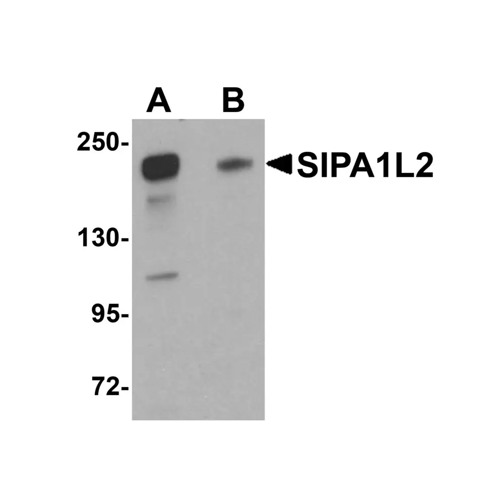 ProSci 5493_S SIPA1L2 Antibody, ProSci, 0.02 mg/Unit Primary Image