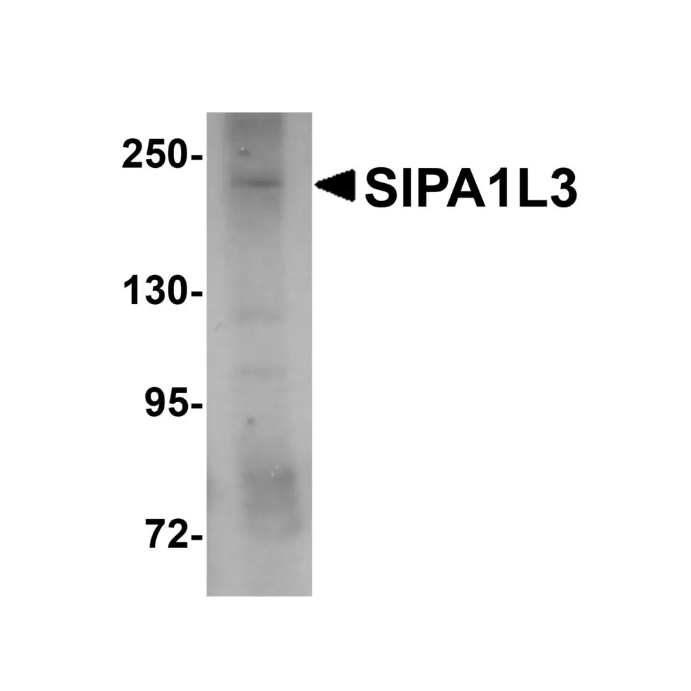 ProSci 5495_S SIPA1L3 Antibody, ProSci, 0.02 mg/Unit Primary Image