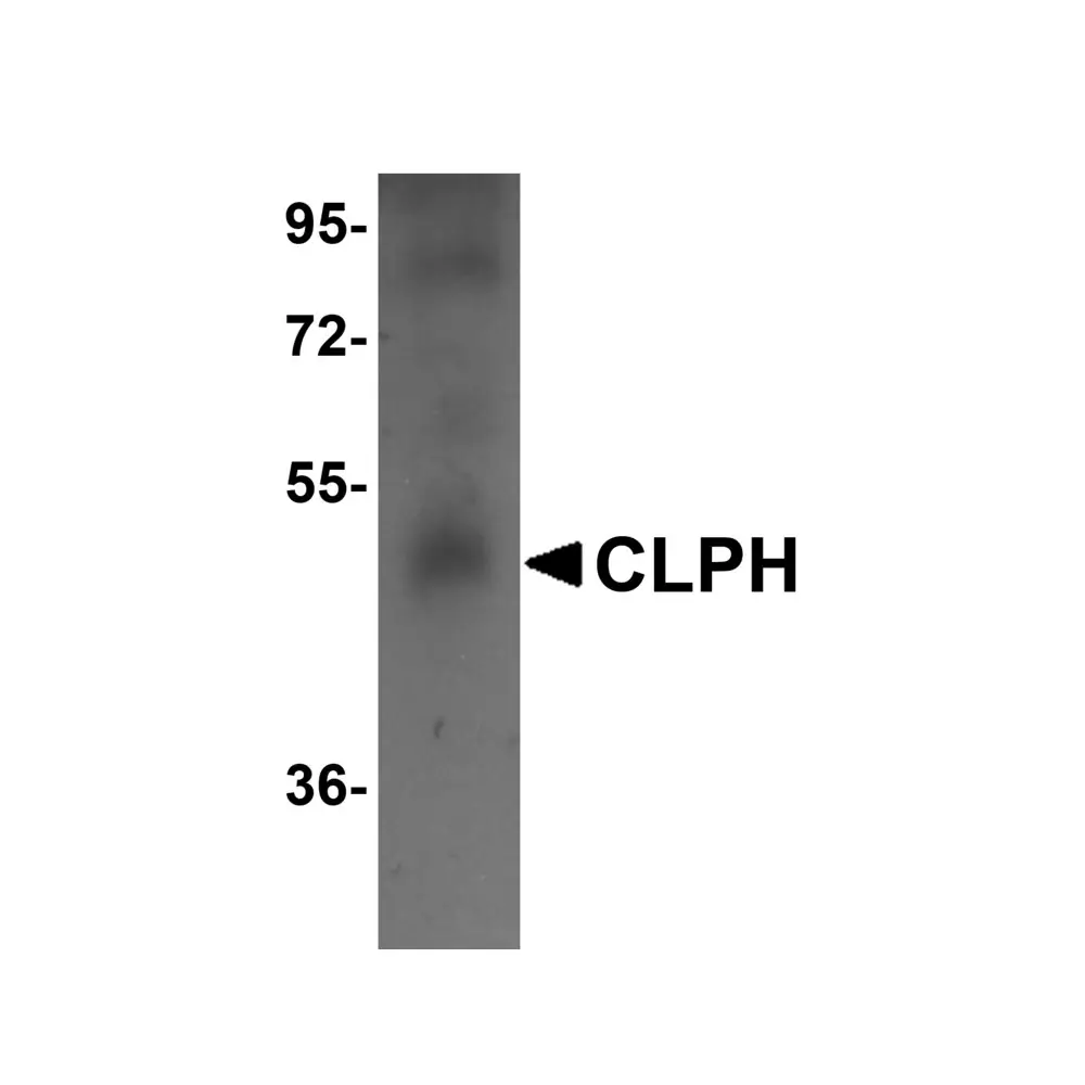 ProSci 5497_S CLPH Antibody, ProSci, 0.02 mg/Unit Primary Image