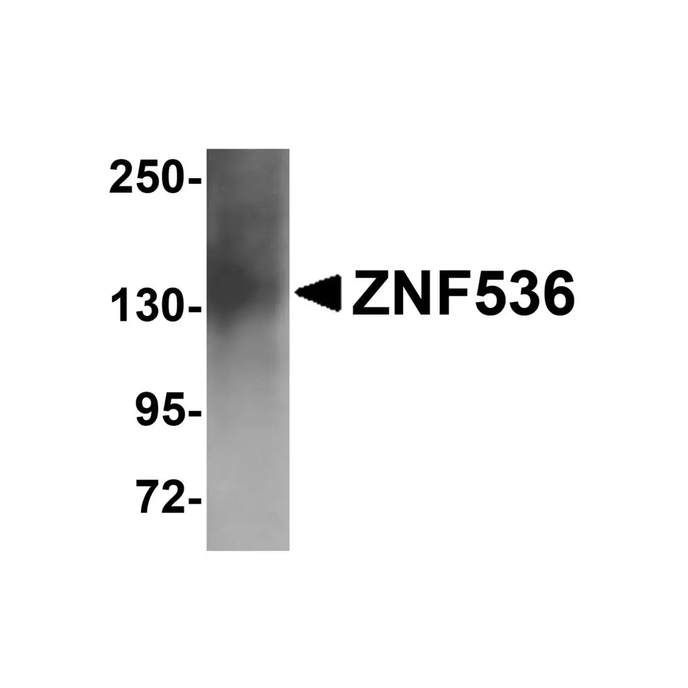 ProSci 5501_S ZNF536 Antibody, ProSci, 0.02 mg/Unit Primary Image