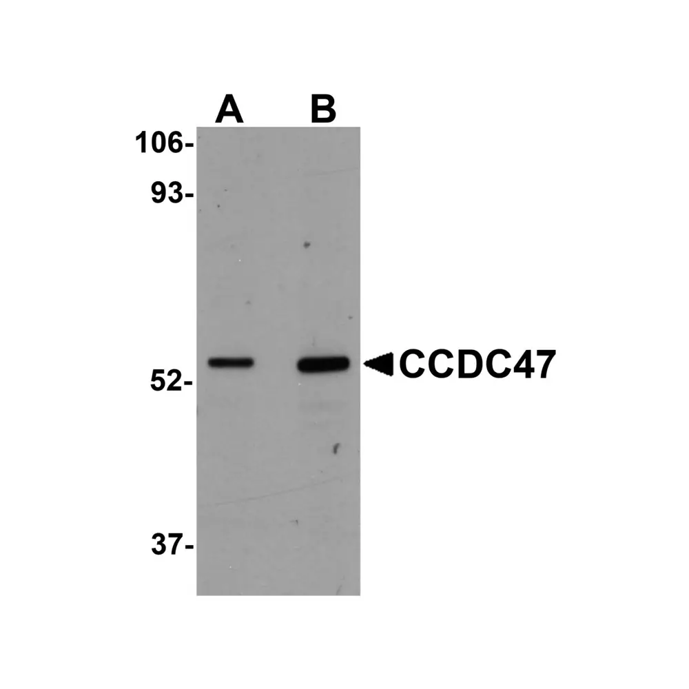 ProSci 5509 CCDC47 Antibody, ProSci, 0.1 mg/Unit Primary Image