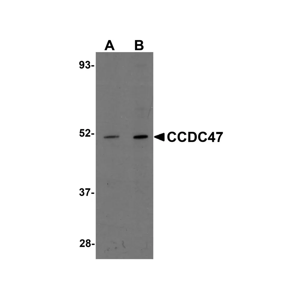 ProSci 5511_S CCDC47 Antibody, ProSci, 0.02 mg/Unit Primary Image