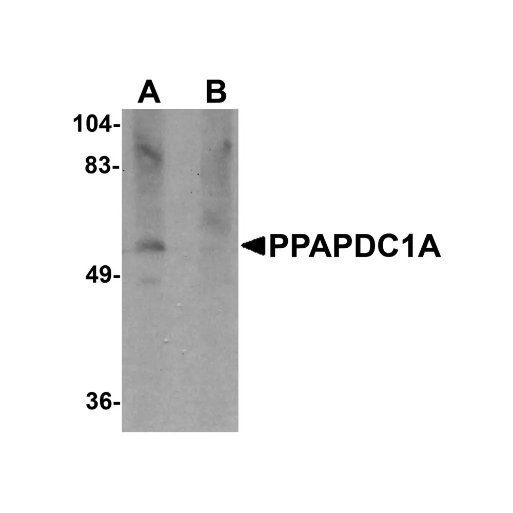ProSci 5513_S PPAPDC1A Antibody, ProSci, 0.02 mg/Unit Primary Image