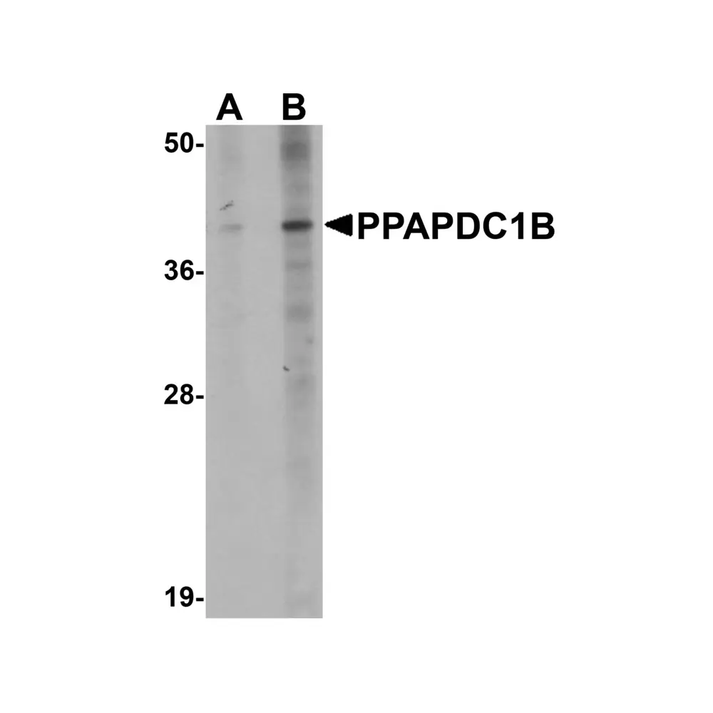 ProSci 5515_S PPAPDC1B Antibody, ProSci, 0.02 mg/Unit Primary Image