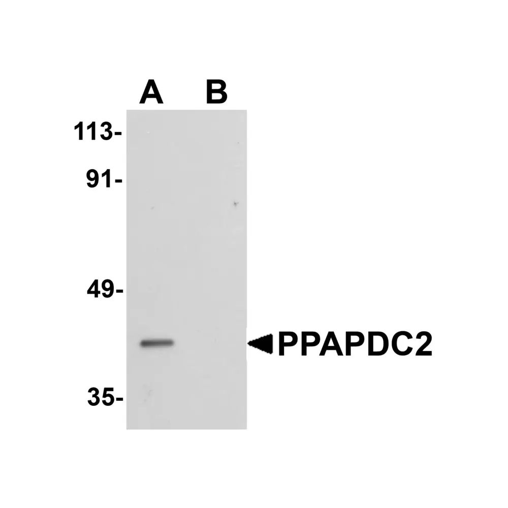 ProSci 5517 PPAPDC2 Antibody, ProSci, 0.1 mg/Unit Primary Image