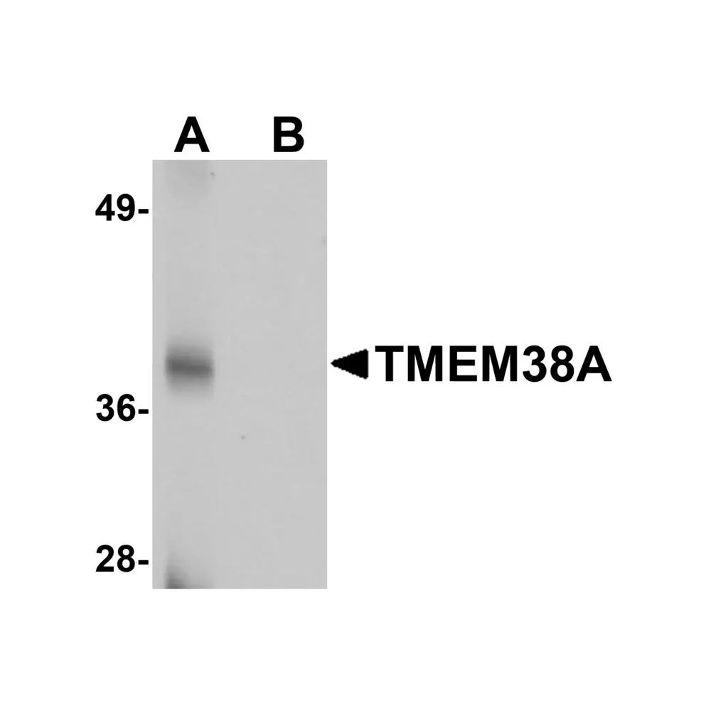 ProSci 5521 TMEM38A Antibody, ProSci, 0.1 mg/Unit Primary Image